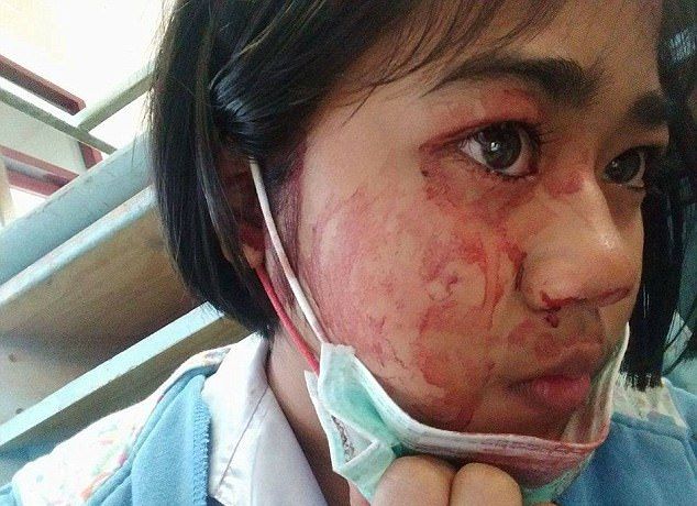Семилетняя тайская девочка плачет кровавыми слезами