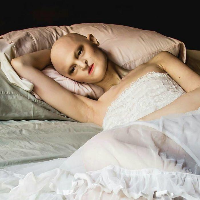 Мелани Гайдос - необычная модель с непростой историей