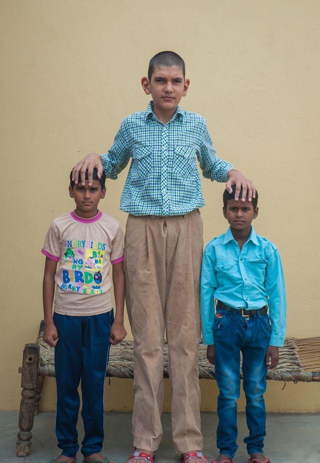 Самый высокий в мире мальчик живет в Индии