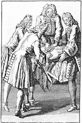 Свищ Людовика Четырнадцатого создал европейскую хирургию и гимн Британии