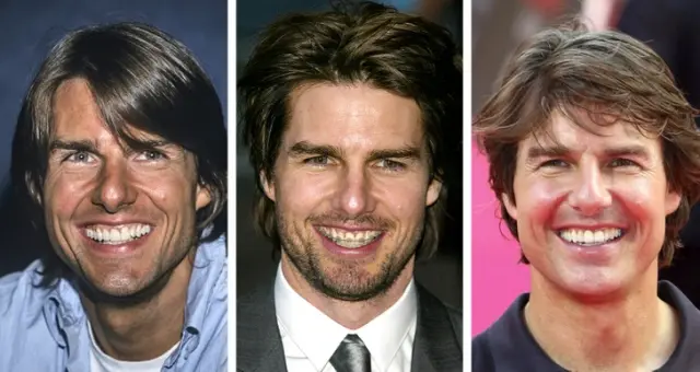 "Цена голливудской улыбки": знаменитости, которые носили брекеты