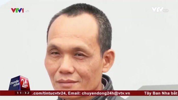 Во Вьетнаме из тела мужчины извлекли зажим, забытый 18 лет назад