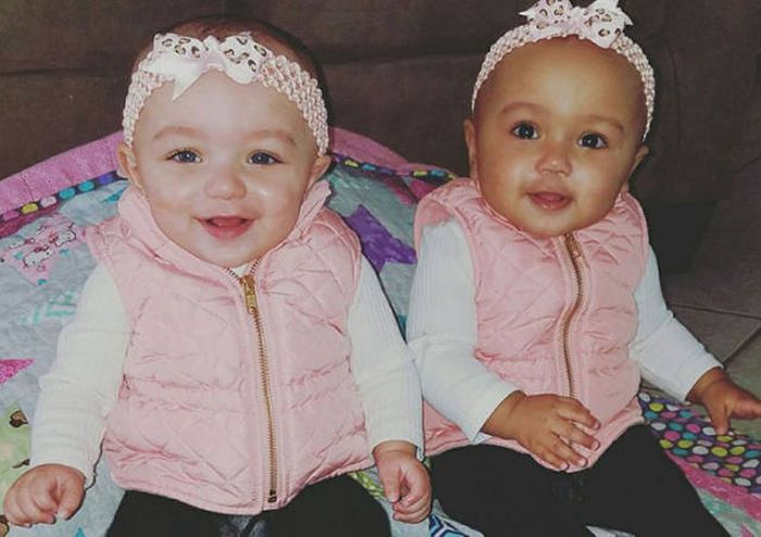 Сестры-близнецы с разным цветом кожи покорили пользователей сети