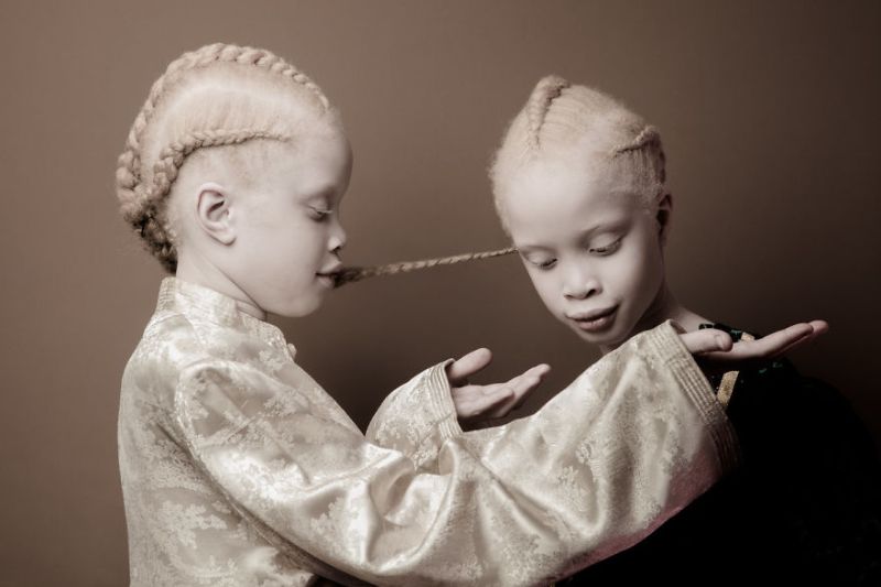 Темнокожие сестры-альбиносы из Бразилии