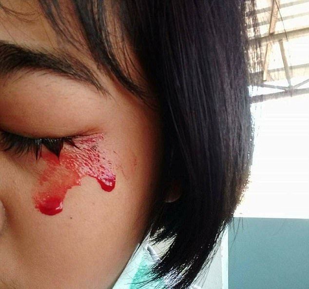 Семилетняя тайская девочка плачет кровавыми слезами