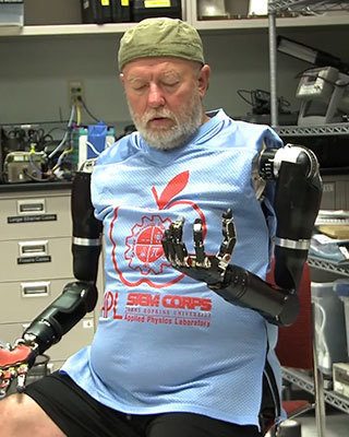 Роботизированные протезы выходят на новый уровень