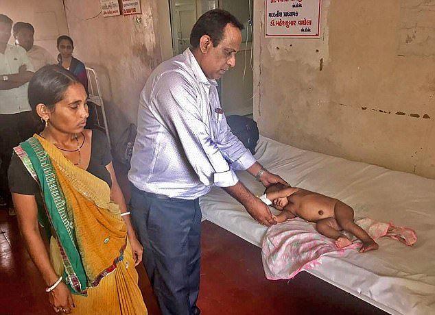 В Индии хирурги ампутировали четвероногой девочке лишние конечности