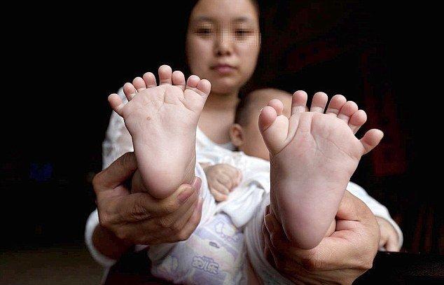 В Китае родился ребенок с 31 пальцем