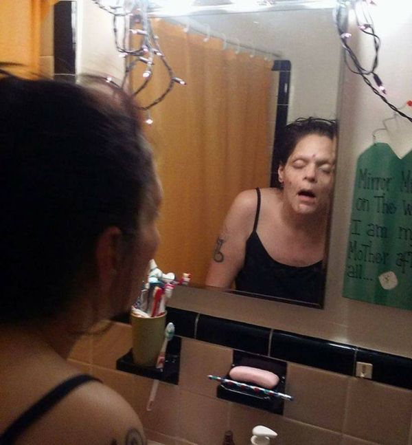 Бывшая наркоманка показала свои фото, чтобы предостеречь остальных от наркотиков