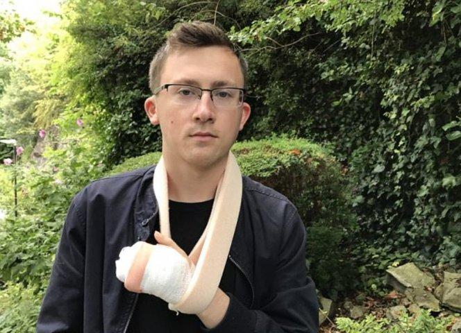 Хирурги спасли руку парня, вшив ее в живот