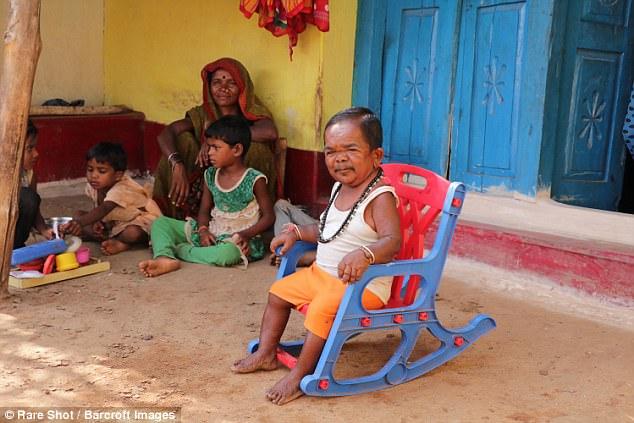 В Индии старик застрял в теле младенца