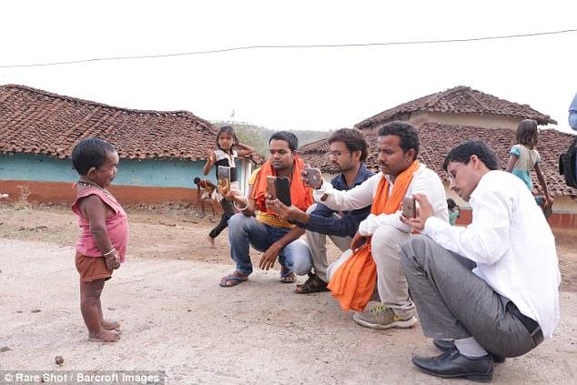 В Индии старик застрял в теле младенца