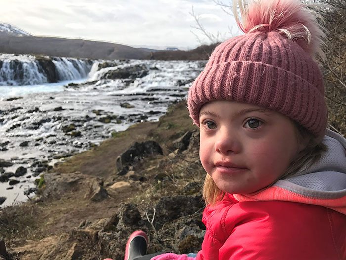  В Исландии все меньше детей рождается с синдромом Дауна