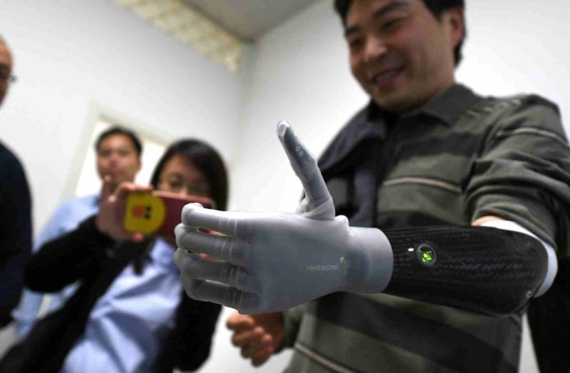 Китаец получил протез с искусственным интеллектом