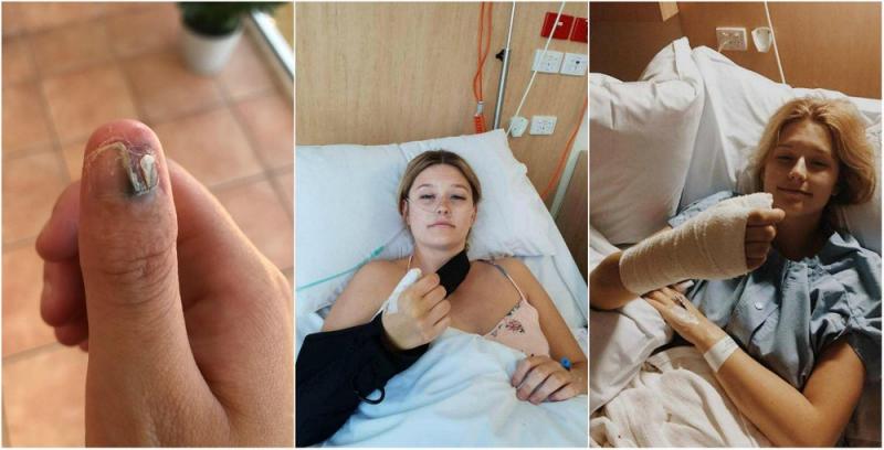 Девушке пришлось ампутировать палец из-за привычки грызть ногти