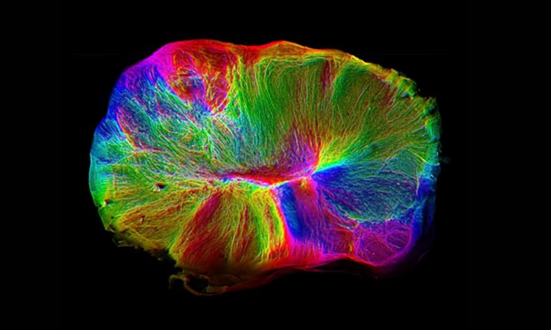 Выращенный в лаборатории миниатюрный мозг самостоятельно соединился со спинным мозгом и мышечной тканью