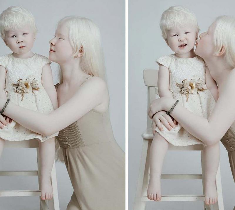 Сёстры-альбиносы из Казахстана