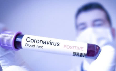 Оперативная информация о распространении коронавирусной инфекции COVID-19 в Украине
