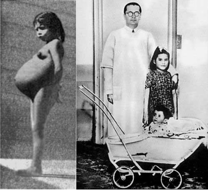 Беременная Лина Ванесса Медина Васкес до и после родов, 1939 год, Перу