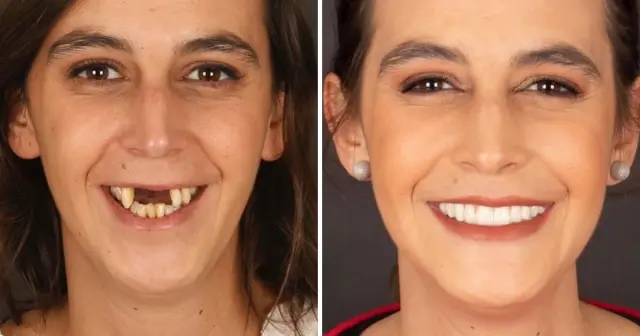 "Сила красивой улыбки": работы португальского дантиста, который преображает своих пациентов