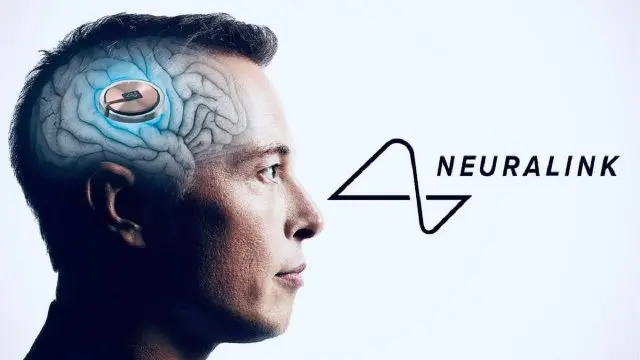 Человек с имплантом от Neuralink Илона Маска научился управлять компьютерной мышкой силой мысли