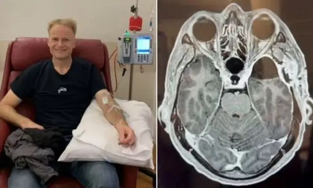 Австралийский врач-онколог победил рак мозга после экспериментального курса терапии
