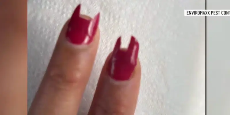 Крыса в Вегасе сгрызла ногти у спящей женщины