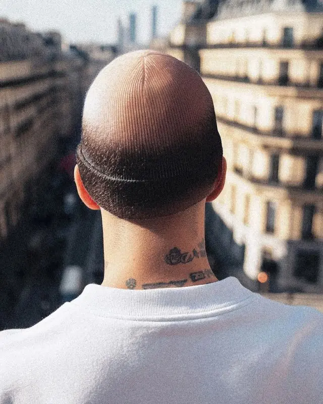 Шапки с "лысиной" завирусились в соцсетях